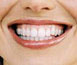 tooth whitening